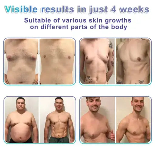 NanoMedix Gynecomastia Chest Fatburn & Firm Patch