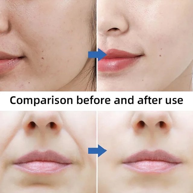 Reduce fine lines, remove wrinkles, moisturizing, firming, V-face lifting mask