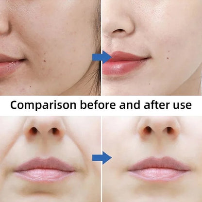 Reduce fine lines, remove wrinkles, moisturizing, firming, V-face lifting mask