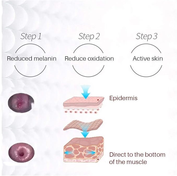 Upwsma Skin Care Mask-suitable for Women's Private Parts-dry-odor and Itching-to Make the Skin Smooth-elastic, Dilute Melanin, Anti-aging Korean Skin Mask