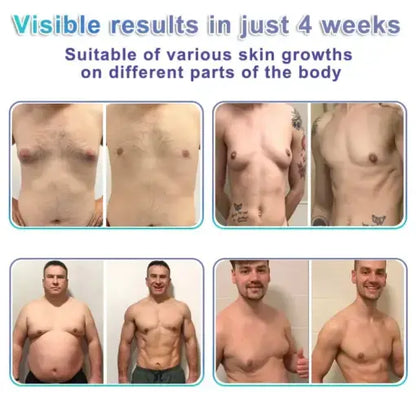 NanoMedix Gynecomastia Chest Fatburn & Firm Patch